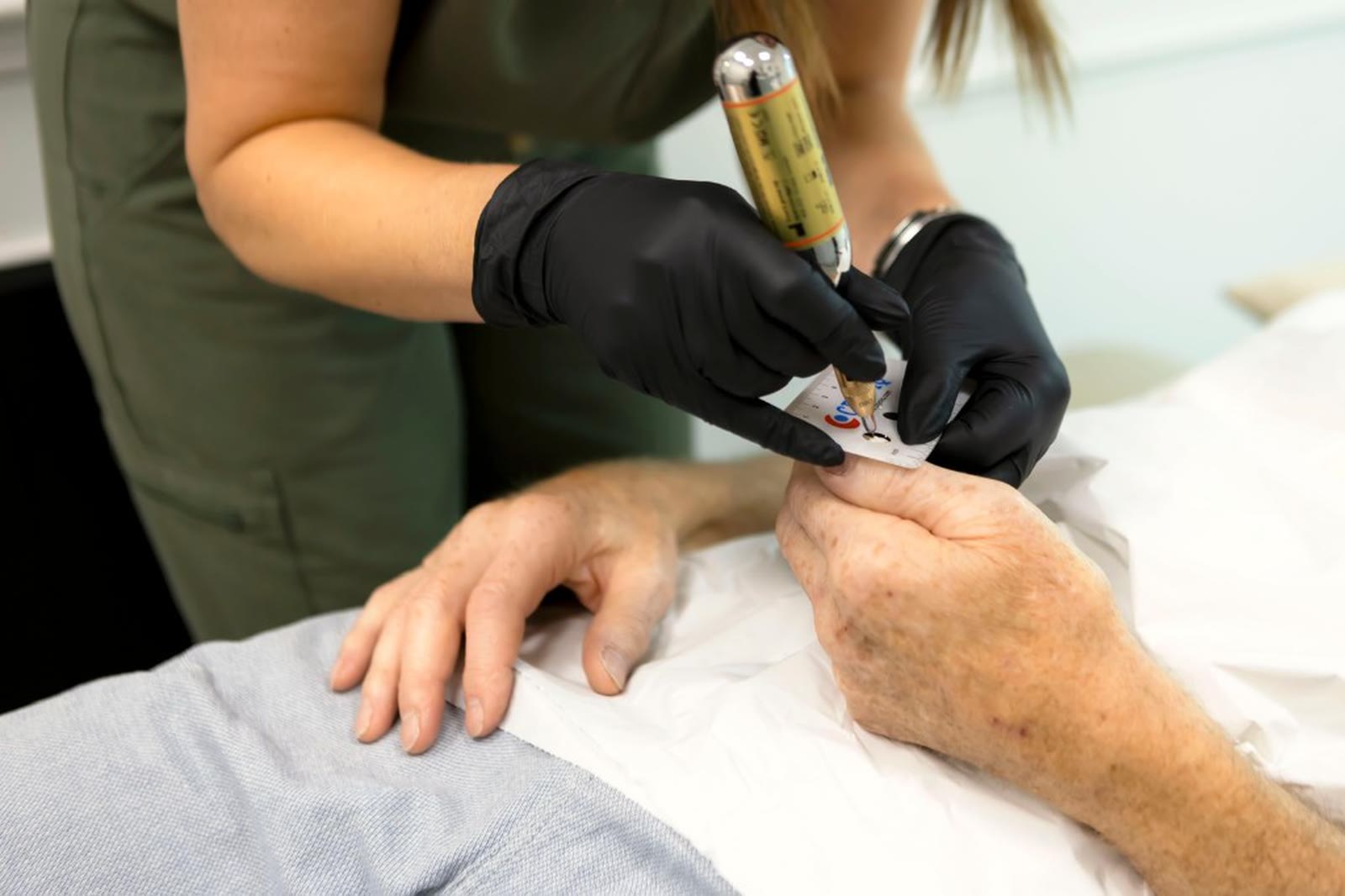 Mo carrying out a precise cryotherapy treatment on a client's hand